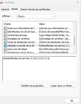 Vue "utilisation avancée"